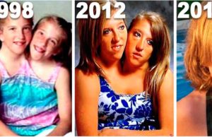 Te acuerdas de las gemelas siamesas Abby y Brittany, así lucen en 2017 es increíble su cambio