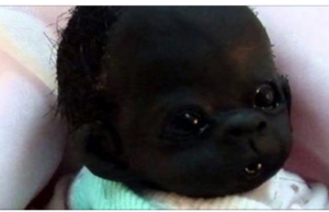 Así luce hoy el bebé más negro del mundo, ahora es más hermoso