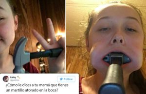 Adolescente pide ayuda a Twitter para sacarse martillo de la boca; quiso cumplir reto millennial