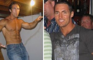 Perdió su rostro por aparición de gran tumor. Su extracción provocó que quedara con la piel expuesta