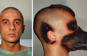 Hombre quiso parecerse a un perro y se implantó sus partes; los resultados fueron increíble!