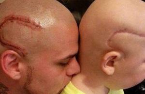 ¿Todos recuerdan al padre que se tatuó la cicatriz de su hijo para apoyarlo? la historia acaba de tener un giro; que toco el corazón a todos