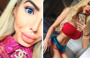 Empezó por los labios, hoy en día ha gastado 40.000 dólares en cirugías para parecerse Barbie