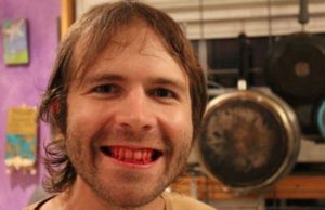 Así es la vida del hombre que come carne cruda y podrida hace 5 años
