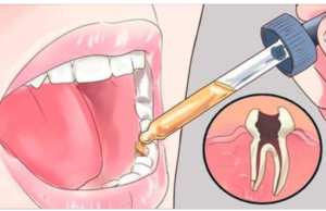 Los dentistas lo tenían bien guardado, elimina las caries y el dolor de muelas con este remedio casero