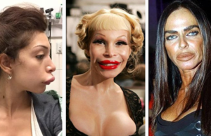 20 Famosas que las cirugías las dejaron horribles, con la #13 hasta Freddy Krueger se espanta