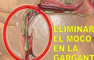 Como puedes eliminar todo el moco y la flema de tu garganta y pulmones