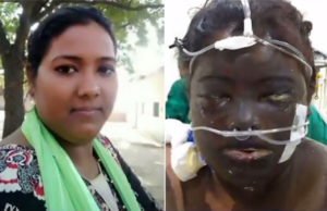 Mujer consigue empleo para mantener a la familia – entonces su marido la encierra y le baña el rostro con ácido