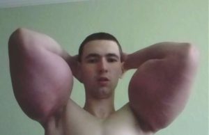 «Popeye»: el joven fisicoculturista ruso al que critican por inyectarse aceite en los brazos