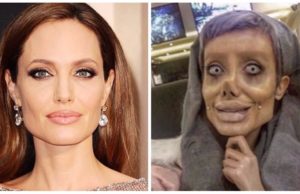 Mujer iraní se ha sometido a 50 cirugías para parecerse a Angelina Jolie; pero fue un desastre
