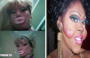 Estas son las peores cirugías plásticas que se han practicado en la historia. ¡WTF!