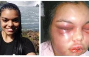 Su marido la golpeaba cada vez que recibía un “Like” en Facebook y desfiguró su rostro