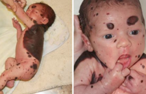 Madre está en shock cuando su hijo nace con puntos sanguinolentos, entonces el médico revela lo impensable