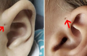 El significado de tener un ‘hoyito’ en la oreja