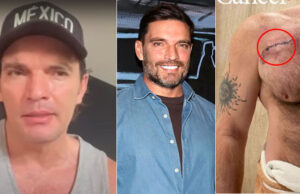 Julián Gil revela fue diagnosticado con cáncer de piel