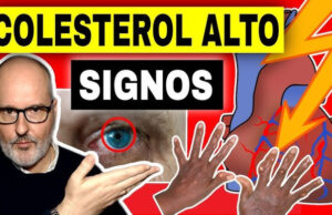 Síntomas del colesterol alto: Señales que no debes ignorar